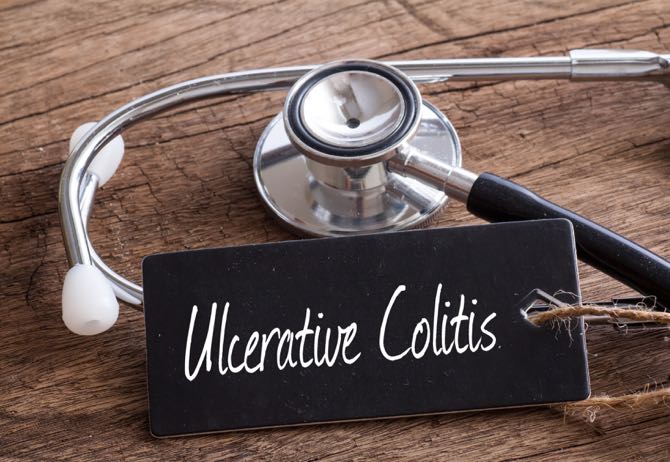 ulcerative colitis title